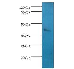 SSTR4 Polyclonal Antibody from Signalway Antibody (42334) - Antibodies.com