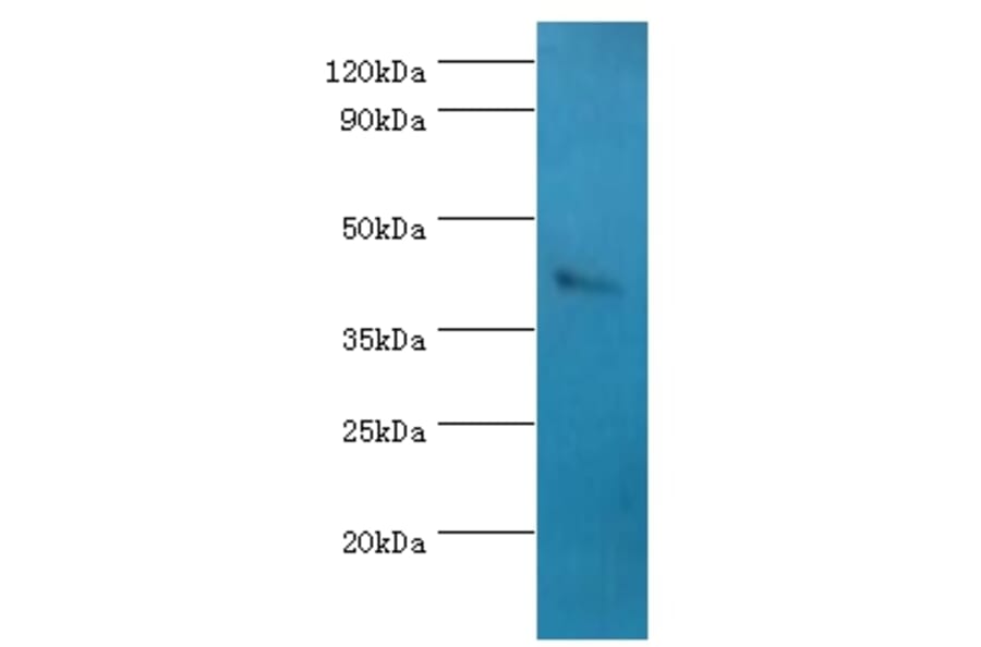 SSTR4 Polyclonal Antibody from Signalway Antibody (42334) - Antibodies.com