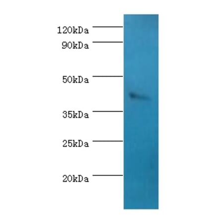 SSTR4 Polyclonal Antibody from Signalway Antibody (42334) - Antibodies.com
