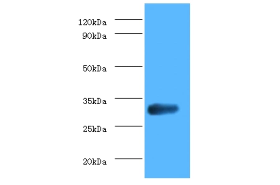 glsA1 Polyclonal Antibody from Signalway Antibody (42626) - Antibodies.com