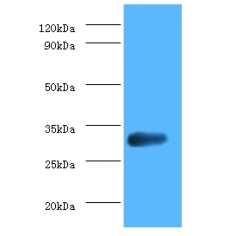 glsA1 Polyclonal Antibody from Signalway Antibody (42626) - Antibodies.com