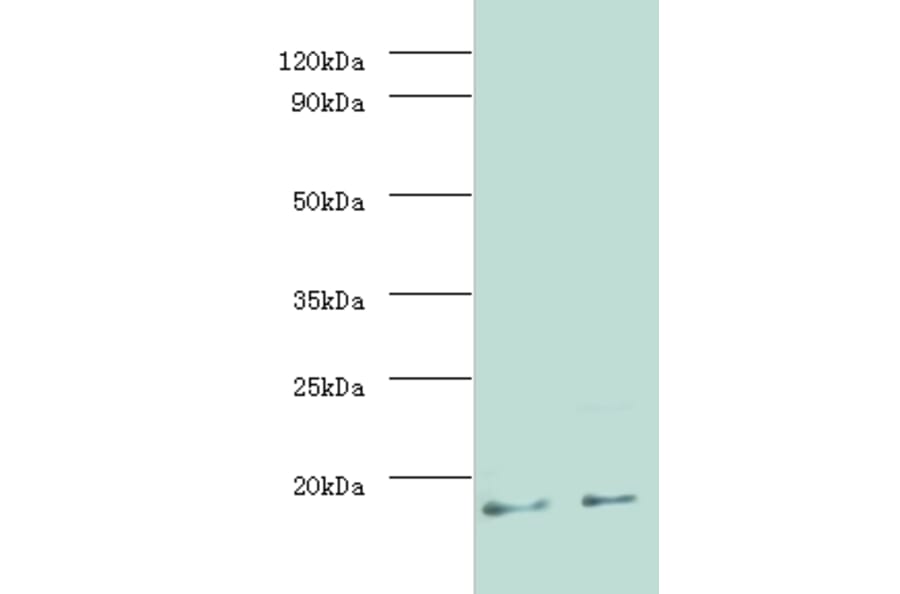 MPT63 Polyclonal Antibody from Signalway Antibody (42635) - Antibodies.com