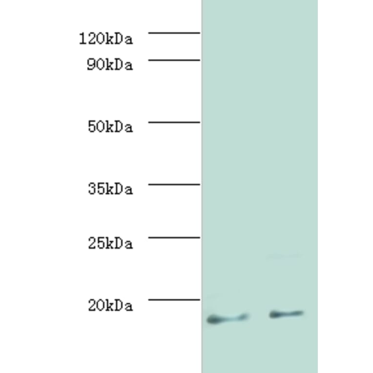 MPT63 Polyclonal Antibody from Signalway Antibody (42635) - Antibodies.com