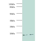 MPT63 Polyclonal Antibody from Signalway Antibody (42635) - Antibodies.com