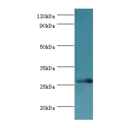 BIRC8 Polyclonal Antibody from Signalway Antibody (42668) - Antibodies.com