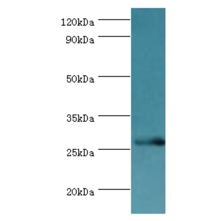 BIRC8 Polyclonal Antibody from Signalway Antibody (42668) - Antibodies.com
