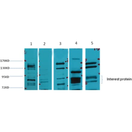 Western blot - Glucocorticoid receptor/GR Rabbit Polyclonal Antibody from Signalway Antibody - Antibodies.com