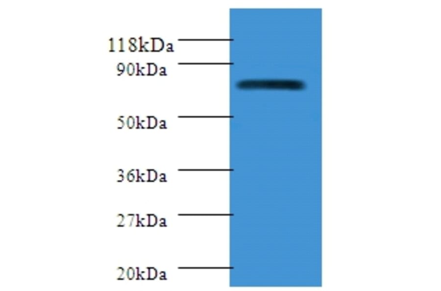 Polymeric immunoglobulin receptor Polyclonal Antibody from Signalway Antibody (42292) - Antibodies.com