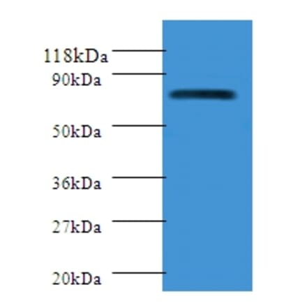 Polymeric immunoglobulin receptor Polyclonal Antibody from Signalway Antibody (42292) - Antibodies.com