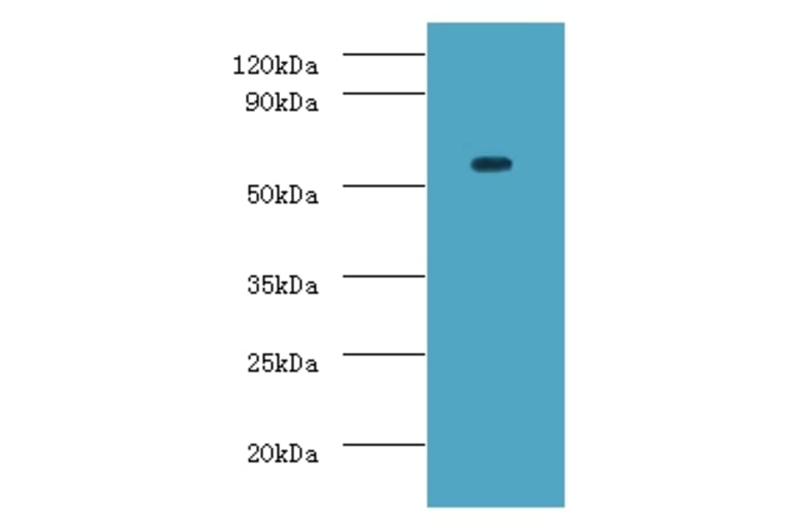 ATP-dependent RNA helicase DDX19A Polyclonal Antibody from Signalway Antibody (42691) - Antibodies.com
