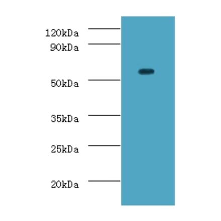 ATP-dependent RNA helicase DDX19A Polyclonal Antibody from Signalway Antibody (42691) - Antibodies.com
