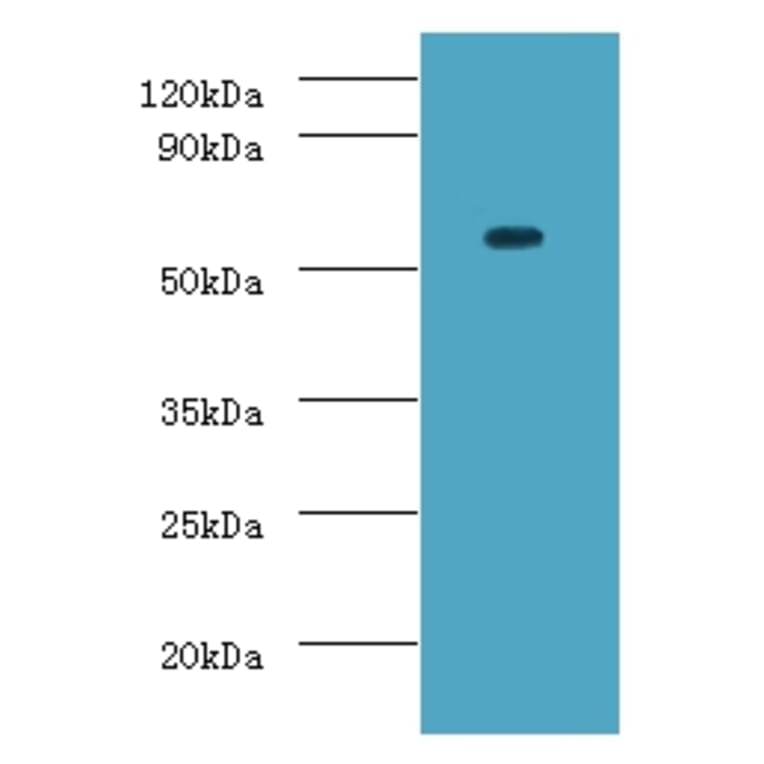 ATP-dependent RNA helicase DDX19A Polyclonal Antibody from Signalway Antibody (42691) - Antibodies.com