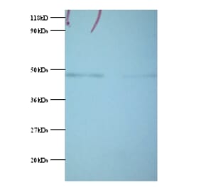 Phosphoglycerate kinase 1 Polyclonal Antibody from Signalway Antibody (42053) - Antibodies.com