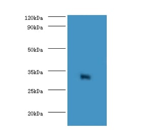 Elongation factor 1-delta Polyclonal Antibody from Signalway Antibody (42154) - Antibodies.com
