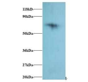 40S ribosomal protein S18 Polyclonal Antibody from Signalway Antibody (42280) - Antibodies.com