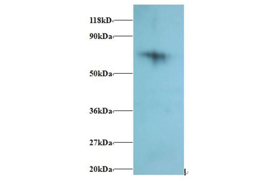 40S ribosomal protein S18 Polyclonal Antibody from Signalway Antibody (42280) - Antibodies.com