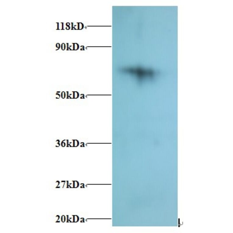 40S ribosomal protein S18 Polyclonal Antibody from Signalway Antibody (42280) - Antibodies.com