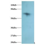 40S ribosomal protein S18 Polyclonal Antibody from Signalway Antibody (42280) - Antibodies.com
