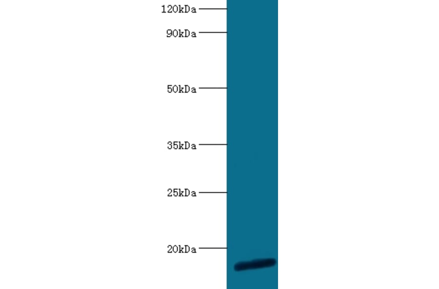 60S ribosomal protein L30 Polyclonal Antibody from Signalway Antibody (42313) - Antibodies.com