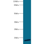 60S ribosomal protein L30 Polyclonal Antibody from Signalway Antibody (42313) - Antibodies.com