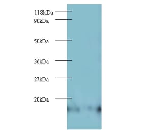 60S ribosomal protein L27 Polyclonal Antibody from Signalway Antibody (42343) - Antibodies.com