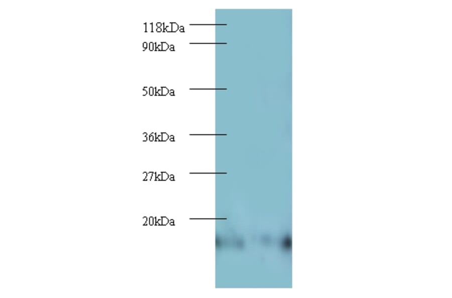 60S ribosomal protein L27 Polyclonal Antibody from Signalway Antibody (42343) - Antibodies.com