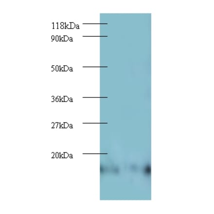 60S ribosomal protein L27 Polyclonal Antibody from Signalway Antibody (42343) - Antibodies.com