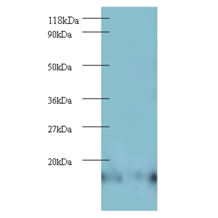 60S ribosomal protein L27 Polyclonal Antibody from Signalway Antibody (42343) - Antibodies.com