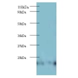 60S ribosomal protein L27 Polyclonal Antibody from Signalway Antibody (42343) - Antibodies.com