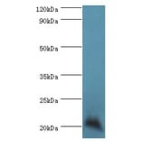 Ganglioside GM2 activator Polyclonal Antibody from Signalway Antibody (42346) - Antibodies.com