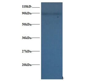 60S ribosomal protein L38 Polyclonal Antibody from Signalway Antibody (42351) - Antibodies.com