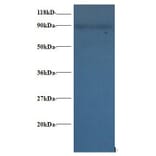 60S ribosomal protein L38 Polyclonal Antibody from Signalway Antibody (42351) - Antibodies.com