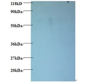 60S ribosomal protein L15 Polyclonal Antibody from Signalway Antibody (42354) - Antibodies.com