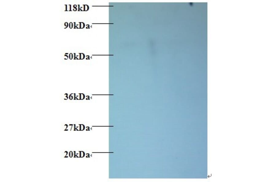 60S ribosomal protein L15 Polyclonal Antibody from Signalway Antibody (42354) - Antibodies.com