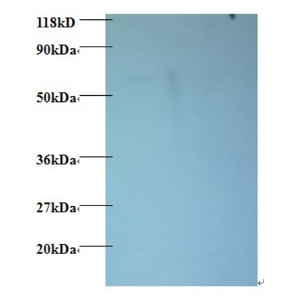 60S ribosomal protein L15 Polyclonal Antibody from Signalway Antibody (42354) - Antibodies.com