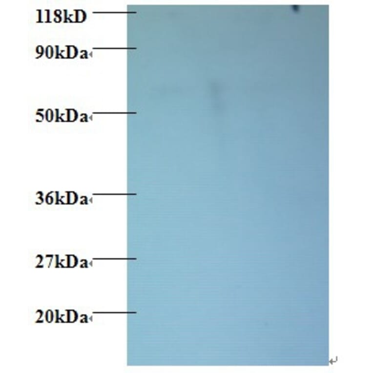 60S ribosomal protein L15 Polyclonal Antibody from Signalway Antibody (42354) - Antibodies.com