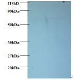 60S ribosomal protein L15 Polyclonal Antibody from Signalway Antibody (42354) - Antibodies.com