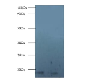 40S ribosomal protein S16 Polyclonal Antibody from Signalway Antibody (42355) - Antibodies.com