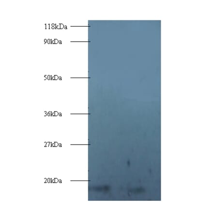 40S ribosomal protein S16 Polyclonal Antibody from Signalway Antibody (42355) - Antibodies.com