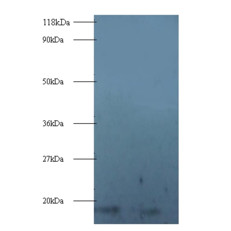 40S ribosomal protein S16 Polyclonal Antibody from Signalway Antibody (42355) - Antibodies.com