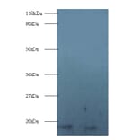 40S ribosomal protein S16 Polyclonal Antibody from Signalway Antibody (42355) - Antibodies.com