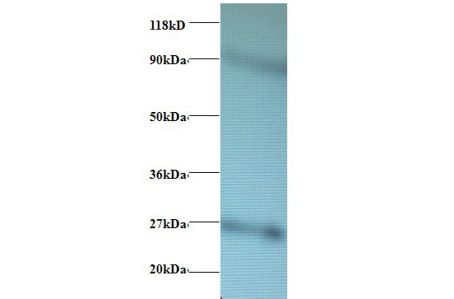 60S ribosomal protein L17 Polyclonal Antibody from Signalway Antibody (42358) - Antibodies.com