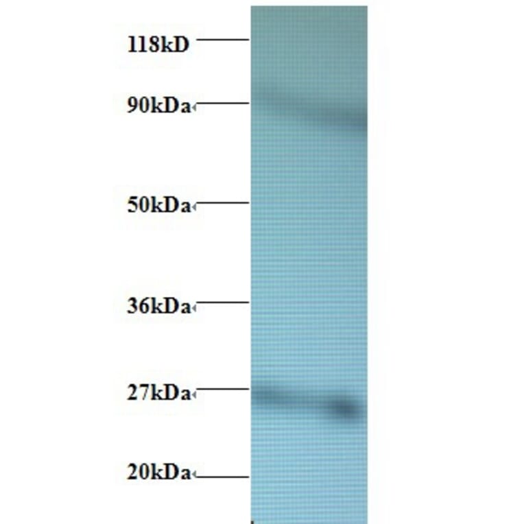 60S ribosomal protein L17 Polyclonal Antibody from Signalway Antibody (42358) - Antibodies.com