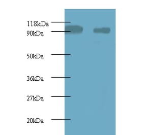 40S ribosomal protein S12 Polyclonal Antibody from Signalway Antibody (42359) - Antibodies.com