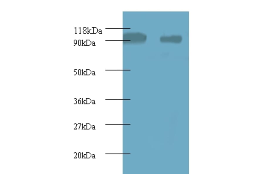 40S ribosomal protein S12 Polyclonal Antibody from Signalway Antibody (42359) - Antibodies.com