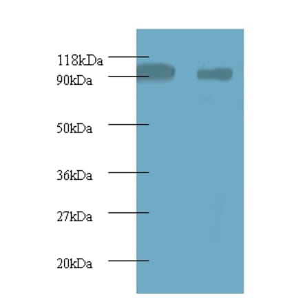 40S ribosomal protein S12 Polyclonal Antibody from Signalway Antibody (42359) - Antibodies.com