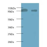 40S ribosomal protein S12 Polyclonal Antibody from Signalway Antibody (42359) - Antibodies.com