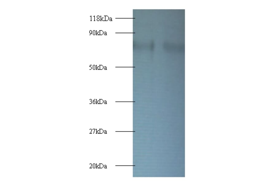 40S ribosomal protein S10 Polyclonal Antibody from Signalway Antibody (42363) - Antibodies.com