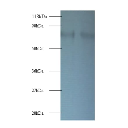 40S ribosomal protein S10 Polyclonal Antibody from Signalway Antibody (42363) - Antibodies.com