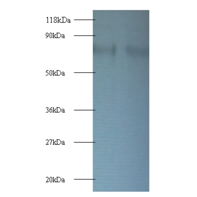 40S ribosomal protein S10 Polyclonal Antibody from Signalway Antibody (42363) - Antibodies.com